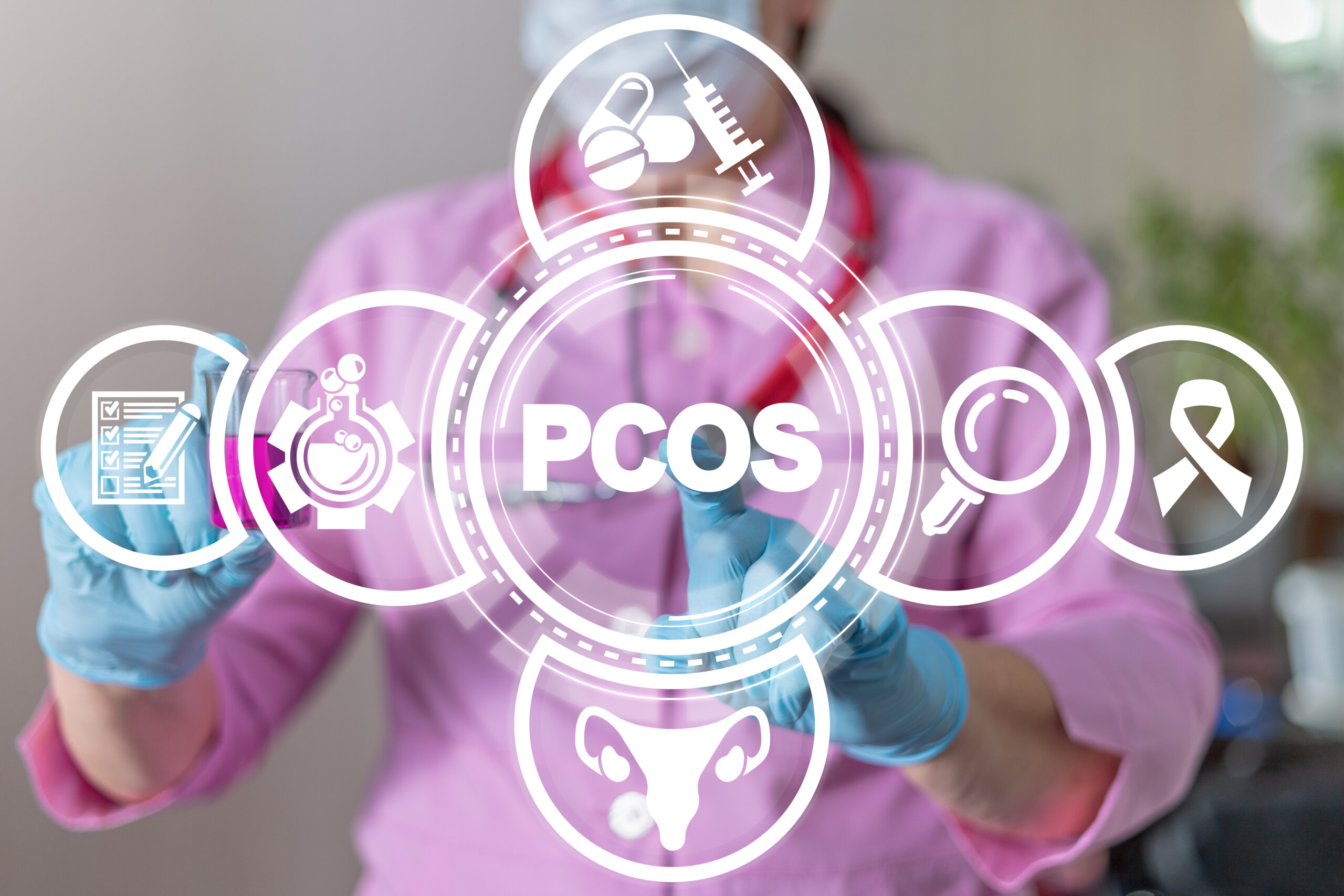 acné_hirsutismo_resistencia_insulina_síndome_ovarios_poliquísticos_SOP_PCOS